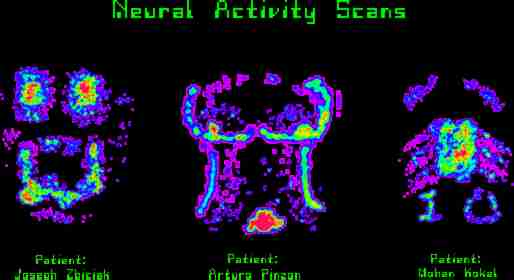 Neural Brain Scan